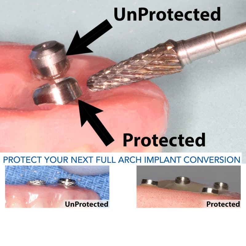 Bidra® Conversion Smart Polishing Cap