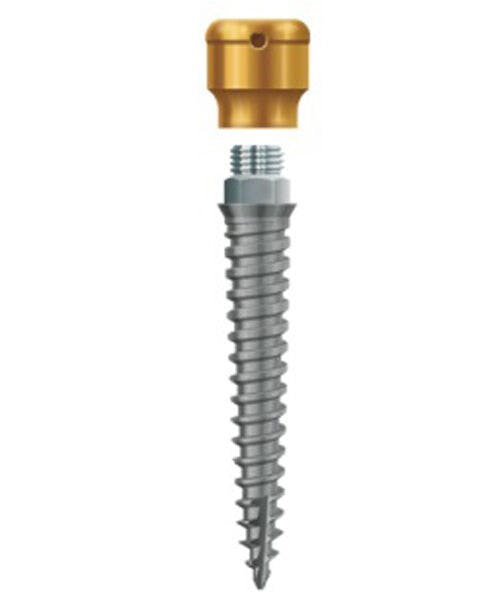 LODI Implant 2.4mm X 14mm, 2.5mm Cuff