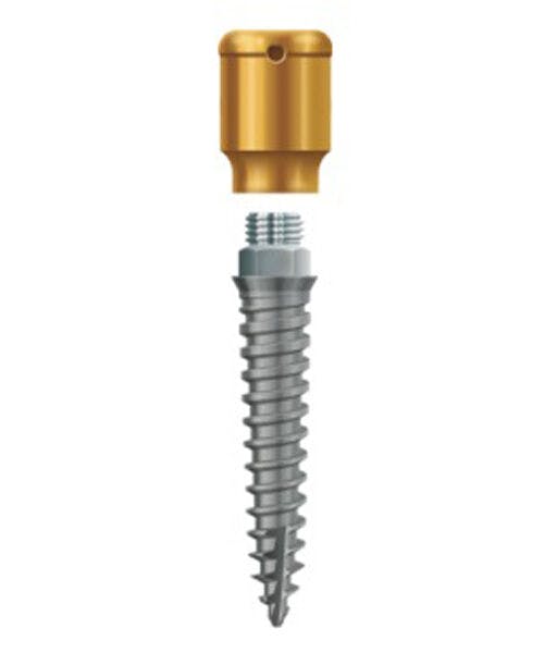 LODI Implant 2.4mm X 12mm, 4mm Cuff