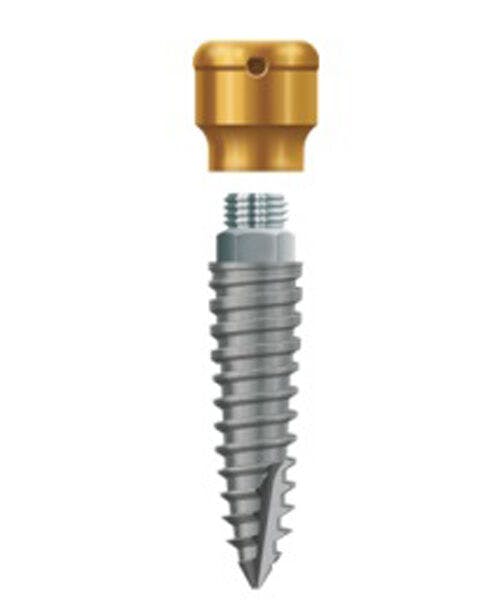 LODI Implant 2.9mm X 10mm, 2.5mm Cuff