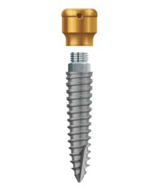 LODI Implant 2.9mm X 12mm, 2.5mm Cuff