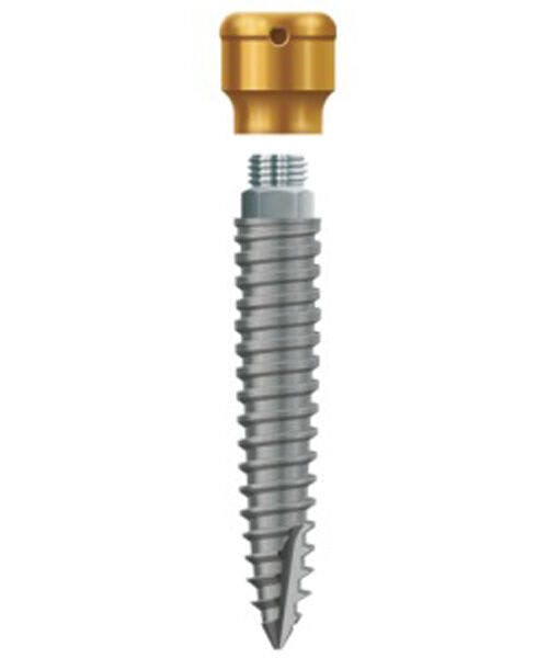 LODI Implant 2.9mm X 14mm, 2.5mm Cuff