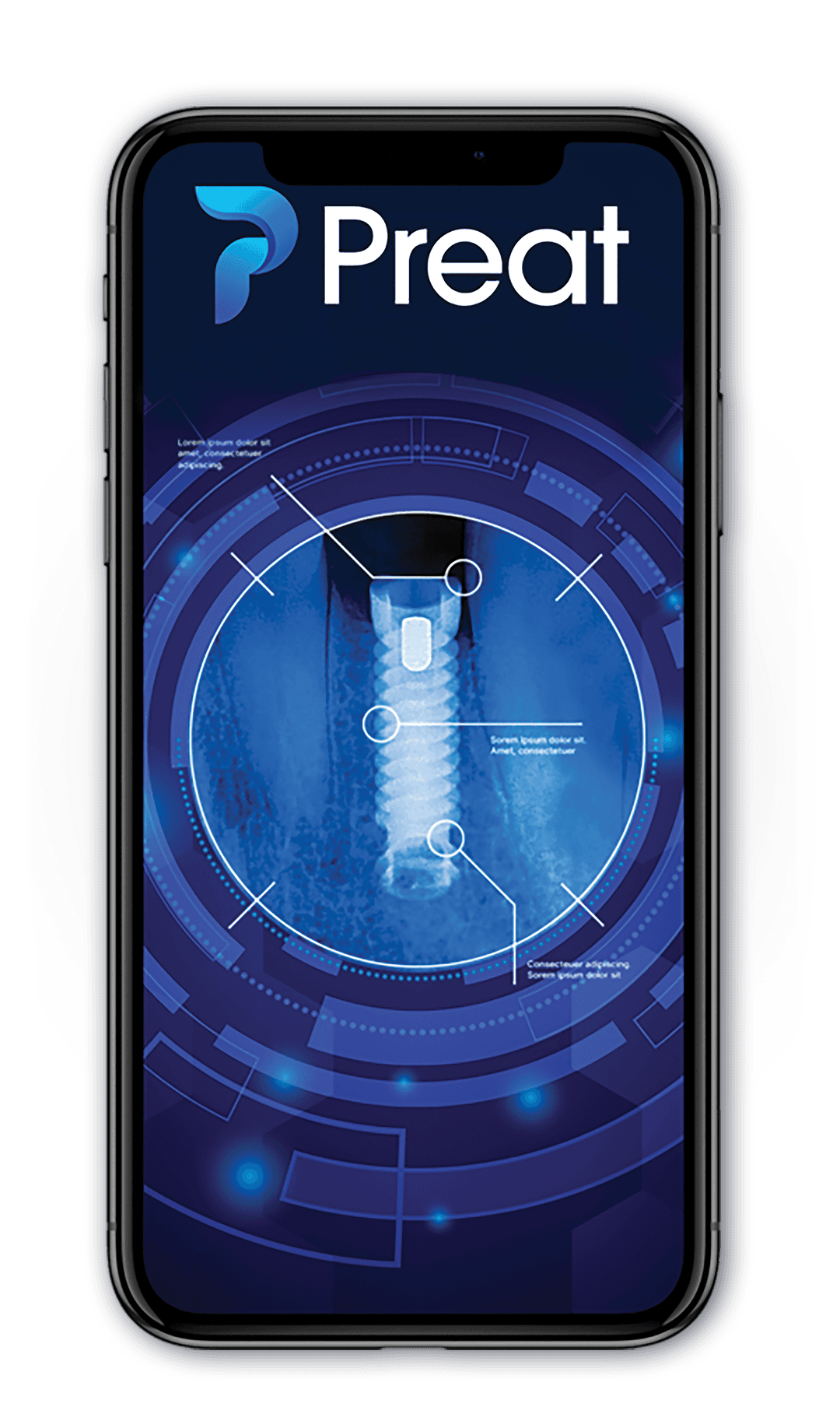 Preat Dental Implant Attachments and Implant Abutments Preat Corporation